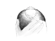 Diagnosi piùefficace